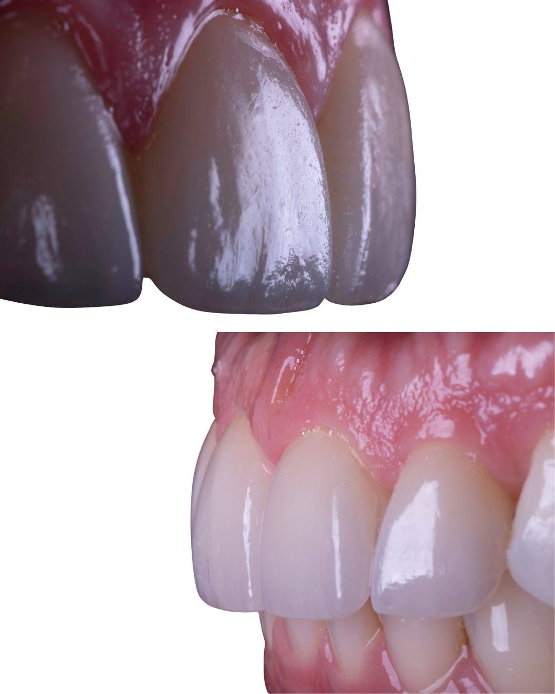 Detalhe aproximado da textura e translucidez da porcelana.
